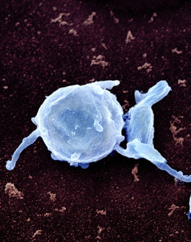 Colored scanning electron micrograph of platelets that have been activated Photo by PhotoResearchers